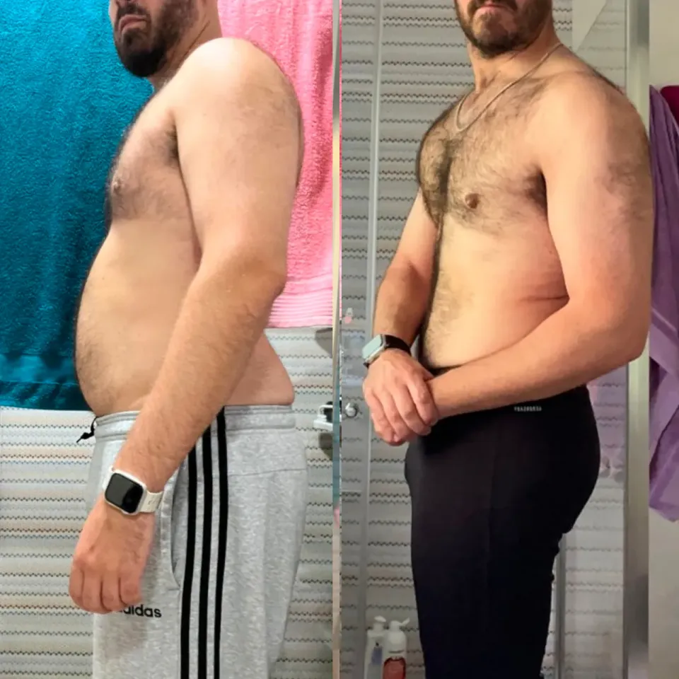 Fotos de antes y después de Carlos