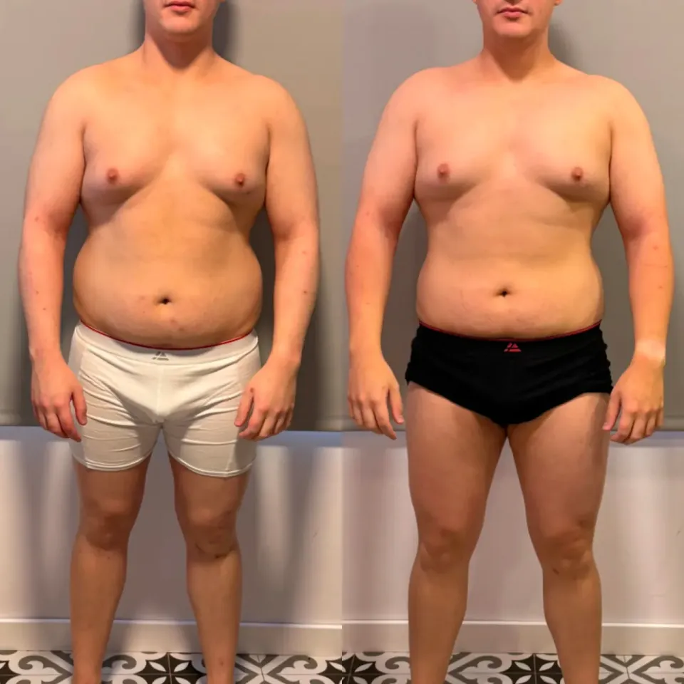 Fotos de antes y después de Diego
