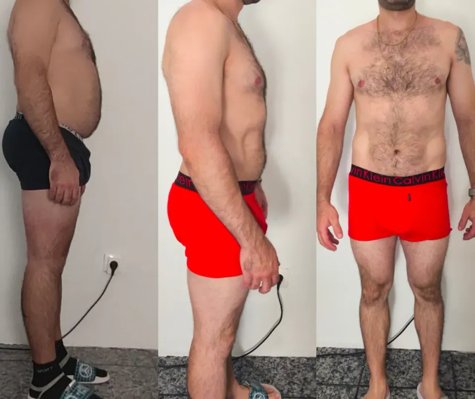 Fotos de antes y después de Juan Carlos
